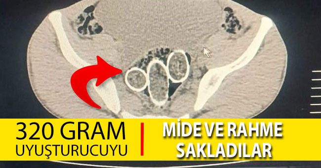 320 Gram Uyuşturucuyu mide ve rahme sakladılar